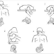 The epley maneuver is based on the canalithiasis theory and involves rotating the posterior semicircular canal backwards, close to its planar orientation. Epley Maneuver For Right Sided Posterior Semicircular Canal Bppv Download Scientific Diagram