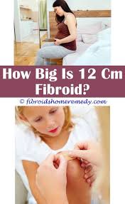 Fibroids Coming Out Uterine Fibroids Fibroid Surgery Cyst On Ovary