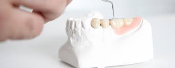 Occlusodontie Dentiste Mouvaux Dr Sarah Zeligzon