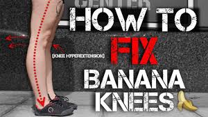 Are you suffering from hyperextended knee injury? How To Fix Banana Knees Knee Hyperextension Functional Leg Training Youtube