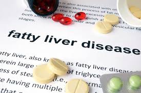 Fatty Liver Disease Written On A Page With Pills Fatty Liver Disease Liver Disease Fatty Liver