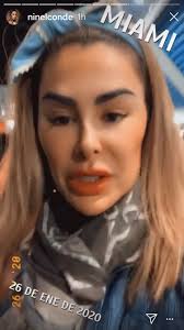 Tenemos para ti videos, imágenes y una amplia cobertura e información actualizada. Arturo Gallegos On Twitter Ninel Conde Empieza A Tener La Cara Chueca No Se Si Sea Por El Botox O Por Estiramiento Facial