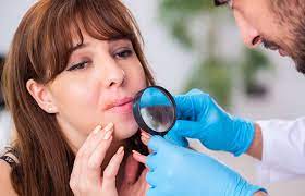 Skin Tag On Lips: A Comprehensive Guide
