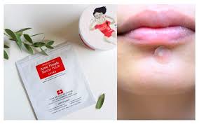 Before acne patches came to exist, you probably saw this same technology in those blister pads you stuck on your heels after a long hike. Cosrx Pimple Master Patch Reviews How To Use It