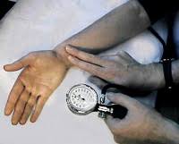 Cardiovascular Lab Blood Pressure Palpatory Method
