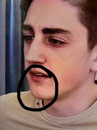 What happened to Danny's chin? : r/DannyGonzalez