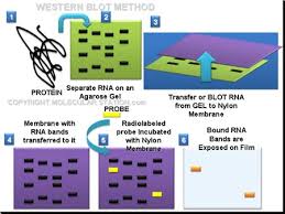 How does western blot work. Western Blot Western Blot