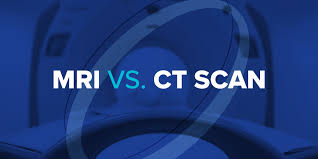 What does the typical ct scan really cost, per the hospital's published reports to the american hospital directory? Mri Vs Ct Scan Health Images