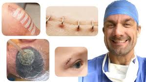Surgical Wound Dehiscence