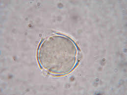 Image result for Caloncoba welwitschii