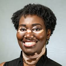 Women's Unique Health Needs and the Sustainable Development Goals (SDGs)