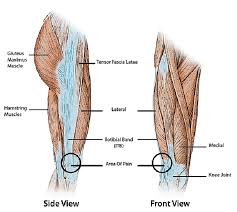 Iliotibial band syndrome (also known as: Iliotibial Band It Band Syndrome Sportnova Uk