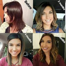 My Before Picture Blows My Mind I Had The Worst Post Partum Hair Loss As A Stylist I Found Good Thick Hair Styles Postpartum Hair Loss Hair Loss Solutions
