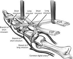 (a) transverse sonogram through the finger flexor tendons at the midpoint of the proximal phalanx shows the division of the superficialis tendon into two slips to surround the profundus tendon, which cannot. Flexor Tendon Injuries Hand Orthobullets