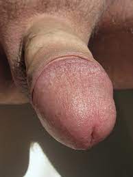 Файл:Close-up glans penis.jpg — Википедия
