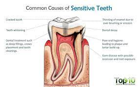 How To Relieve Tooth Sensitivity Home Remedies And Tips Top 10 Home Remedies Sensitive Teeth Tooth Sensitivity Sensitive Teeth Remedy