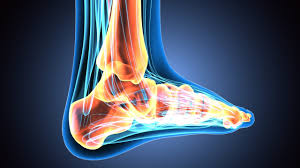 Near normal foot mri for reference. Wbct Mri Study Sheds Light On Flat Foot Degeneration Curvebeam