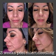 TOP 10 BEST Colon Cleanse near Montrose, Houston, TX