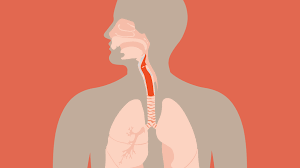 Changes in voice are also sometimes associated with caner of the larynx. Laryngeal Cancer Treatment Surgery Or Chemoradiation For Cancer