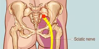 The lymphoid organs assist the lymphatic system. How To Sleep With Lower Back Pain And Sciatica