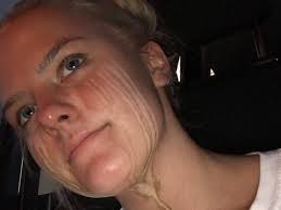 Spray Tan Fail Photo Goes Viral On Social Media Teen Vogue