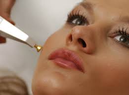 Lazerle ben tedavisi nasıl yapılır?