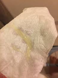 Is This Mucus Plug Babycenter