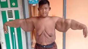 Impresionante El Tremendo Cambio Fisico Del Nino Mas Obeso Del Mundo Que Desea Ser Futbolista