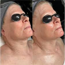 ✨ Lifted, Firm, and Glowing