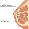 Cancers are maternal, domestic, and love to nurture others. 1