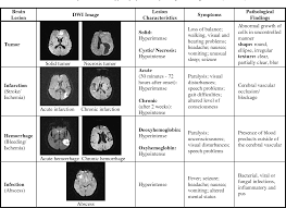 Image result for Brain Lesion