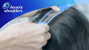 Hair and loss hair regrowth grow for men and women hair loss treatment shampoo spray lotion anti hair fall. Head Shoulders Helps Reduce Hair Fall Caused By Dandruff Head And Shoulders Shampoo Youtube