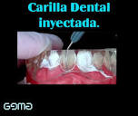 Dentista, Gema,Tlaxcala.Crystal Herrera