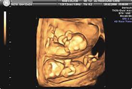 Looking for an old soul like myself. Ultrasound Examination Establishing The Gestational Age Of The Pregnancy Ultrasound Care