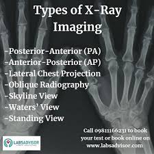 50 Off On X Ray Cost In India Starting From 170 Only