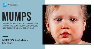 Image result for Mumps