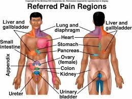 Nature & location of pain. Referred Pain Eagle Sports Family