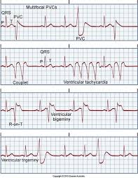 Pin By Tammy Hayes On Nursing Medical Surgical Nursing Icu Nursing Cardiology Nursing