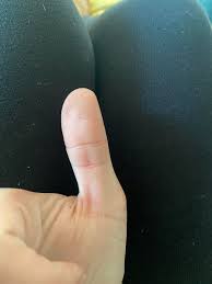 You should carefully examine the first knuckle of the thumb and lines found there. 20f Is This Considered To Be A Phoenix Eye This Is My Right Dominant Hand Palmistry