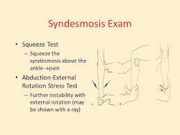 Image result for Ankle External Rotation Test