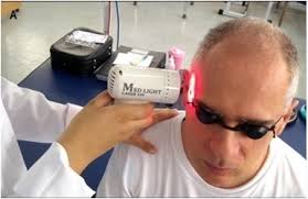 REABILITAÇÃO SENSÓRIO-MOTORA ASSOCIADA À FOTOBIOMODULAÇÃO TRANSCRANIANA EM  PACIENTES COM LESÃO DO SISTEMA NERVOSO CENTRAL