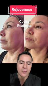 #cuello#firmeza#juventud#belleza#rejuvenecedor  ##arrugas#flacidez#manchas#antiaging #rejuvenescimento