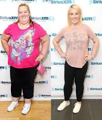 Photos From Before And After Celebs Who Have Admitted To Weight Loss Surgery E Online