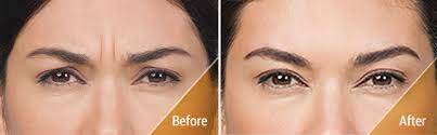 Nuderma health and med spa. Nuderma Health Medical Spa Services Skin Care Center In Raleigh Nc
