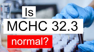 Is Mchc 32 3 Normal High Or Low What Does Mean Corpuscular Hemoglobin Concentration Level 32 3 Mean