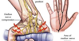 Numb Hands Tingly Fingers Sore Wrists Here S The Why And How On Preventing It Bike Ride Mountain Biking Cycling Women