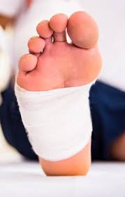 Diabetic wound care specialist near me. Diabetic Foot Care Certified Wound Care Specialist Hartford Rocky Hill Ct Hartford Podiatry Group