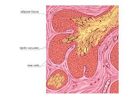 Image result for Sebaceous Gland