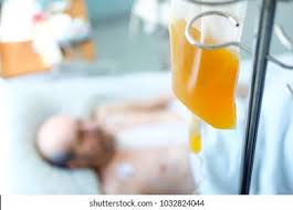 Image result for Platelet Transfusion