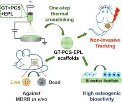 The mdrd gfr equation estimates glomerular filtration rate based on creatinine and patient characteristics. Biomimetic Bioactive Multifunctional Poly Citrate Siloxane Based Nanofibrous Scaffolds Enable Efficient Multidrug Resistant Bacterial Treatment Non Invasive Tracking In Vitro In Vivo Sciencedirect